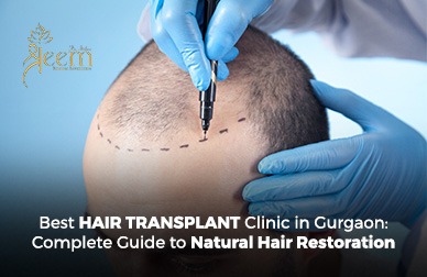 Best Hair Transplant Clinic in Gurgaon Complete Guide to Natural Hair Restoration