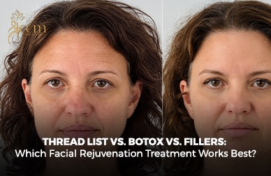 Thread List Vs. Botox Vs. Fillers: Which Facial Rejuvenation Treatment Works Best?