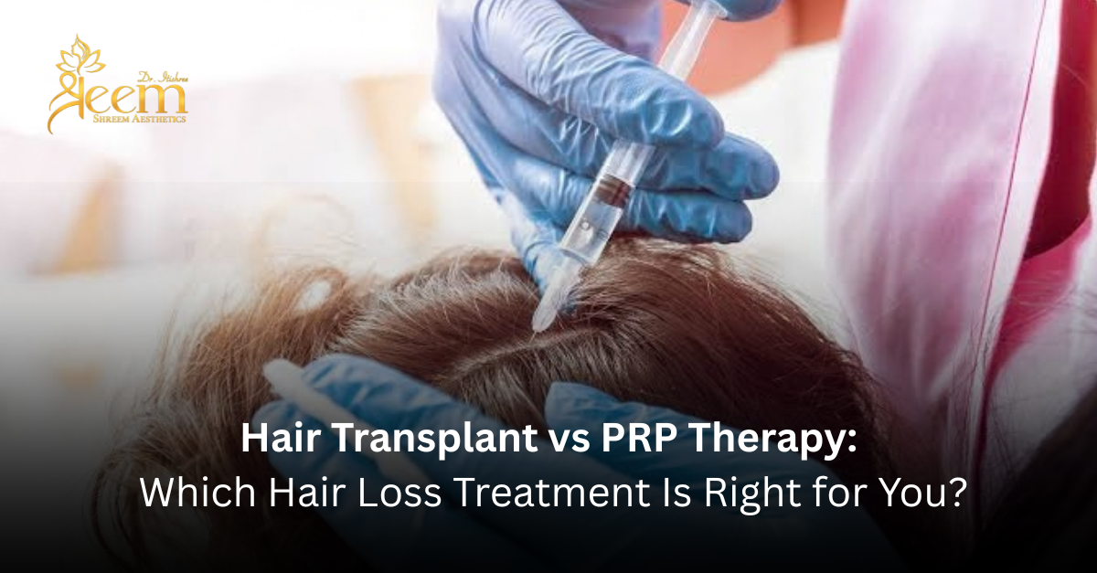 Hair Transplant vs PRP Therapy: Which Hair Loss Treatment Is Right for You?